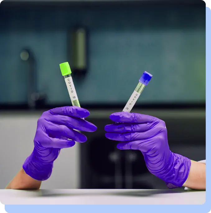 Gloved hands in a laboratory setting holding two labeled medical test tubes with green and blue caps.