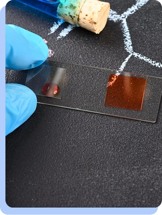 A close-up of a gloved hand holding a microscope slide with a drop of blood on it, positioned over a dark surface with chemical structures drawn in chalk.