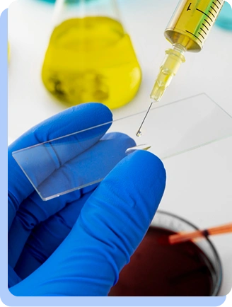 A close-up of a hand in a blue glove holding a clear glass microscope slide while a pipette dispenses a drop of liquid onto it. A beaker of yellow liquid is in the background.