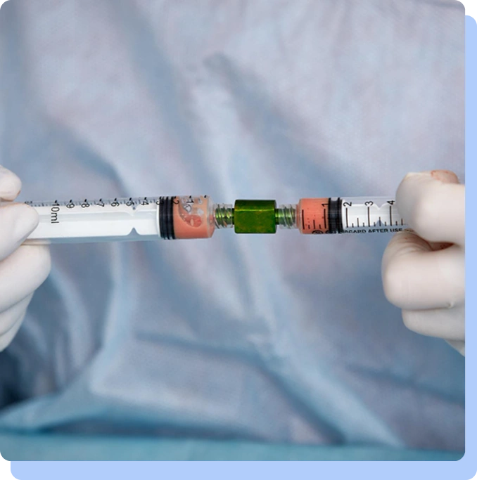 Two syringes connected at the needles by a green medical adapter, held by gloved hands.