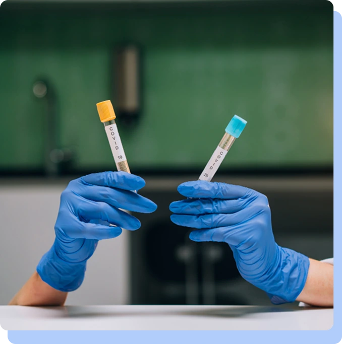 Gloved hands holding up two medical sample tubes with yellow and blue caps in a laboratory setting.