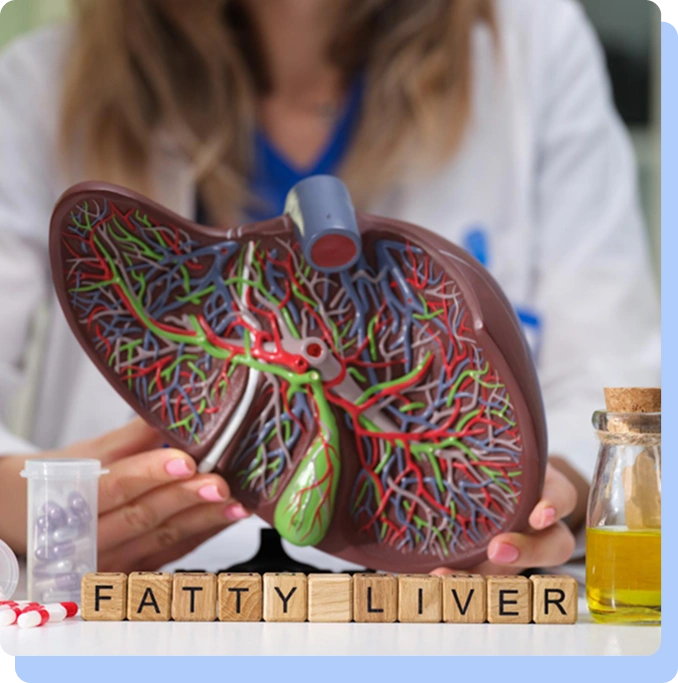 A researcher sits behind a detailed anatomical model of a human liver showing the internal vein and artery structure. In front of the model, wooden blocks spell out the words "FATTY LIVER." A small vial of purple capsules and a bottle of yellow oil are also visible on the desk.